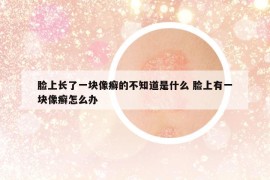 臉上長了一塊像癬的不知道是什么 臉上有一塊像癬怎么辦