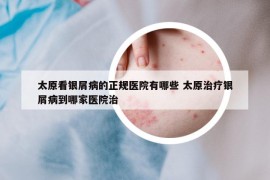太原看銀屑病的正規(guī)醫(yī)院有哪些 太原治療銀屑病到哪家醫(yī)院治