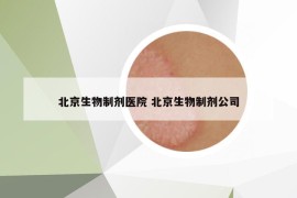 北京生物制劑醫(yī)院 北京生物制劑公司