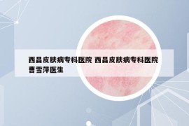 西昌皮膚病?？漆t(yī)院 西昌皮膚病?？漆t(yī)院 曹雪萍醫(yī)生