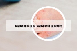 成都銀康病醫(yī)院 成都市銀康醫(yī)院好嗎