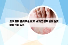 點(diǎn)滴型銀屑病顏色變深 點(diǎn)滴型銀屑病顏色變深褐色怎么辦