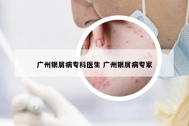 廣州銀屑病?？漆t(yī)生 廣州銀屑病專家