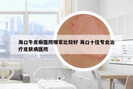 海口牛皮癬醫(yī)院哪家比較好 ?？谑褜I(yè)治療皮膚病醫(yī)院