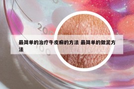 最簡單的治療牛皮癬的方法 最簡單的做泥方法