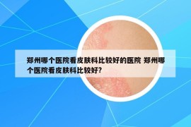 鄭州哪個(gè)醫(yī)院看皮膚科比較好的醫(yī)院 鄭州哪個(gè)醫(yī)院看皮膚科比較好?
