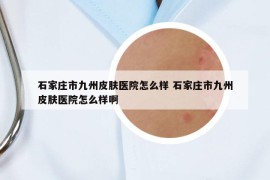 石家莊市九州皮膚醫(yī)院怎么樣 石家莊市九州皮膚醫(yī)院怎么樣啊