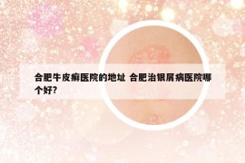 合肥牛皮癬醫(yī)院的地址 合肥治銀屑病醫(yī)院哪個(gè)好?
