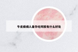牛皮癬病人備孕吃阿膠有什么好處