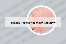 銀屑病能和寵物住一屋 銀屑病能養(yǎng)動物嗎