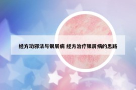 經(jīng)方功邪法與銀屑病 經(jīng)方治療銀屑病的思路