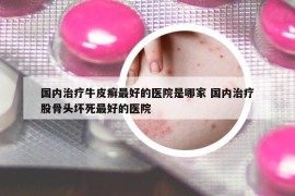 國(guó)內(nèi)治療牛皮癬最好的醫(yī)院是哪家 國(guó)內(nèi)治療股骨頭壞死最好的醫(yī)院