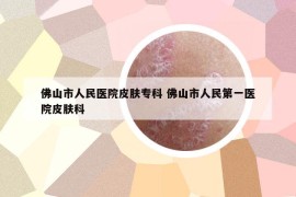 佛山市人民醫(yī)院皮膚?？?佛山市人民第一醫(yī)院皮膚科