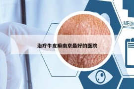治療牛皮癬南京最好的醫(yī)院