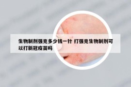 生物制劑強克多少錢一針 打強克生物制劑可以打新冠疫苗嗎