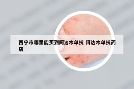 西寧市哪里能買到阿達(dá)木單抗 阿達(dá)木單抗藥店