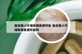 做皮膚ct不排除銀屑病可能 做皮膚ct不排除銀屑病可能嗎