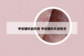 甲安蝶呤副作用 甲安蝶呤片說明書