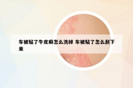 車被貼了牛皮癬怎么洗掉 車被貼了怎么刮下來