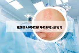 維生素AD牛皮癬 牛皮癬維a酸乳膏