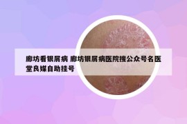 廊坊看銀屑病 廊坊銀屑病醫(yī)院搜公眾號名醫(yī)堂良媒自助掛號