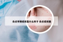 白點(diǎn)早期癥狀是什么樣子 白點(diǎn)癥狀圖
