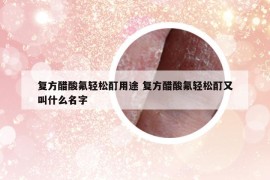 復方醋酸氟輕松酊用途 復方醋酸氟輕松酊又叫什么名字
