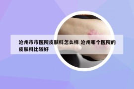 滄州市市醫(yī)院皮膚科怎么樣 滄州哪個醫(yī)院的皮膚科比較好
