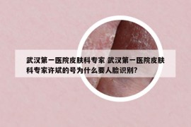 武漢第一醫(yī)院皮膚科專家 武漢第一醫(yī)院皮膚科專家許斌的號(hào)為什么要人臉識(shí)別?