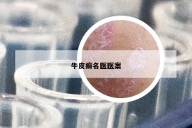 牛皮癬名醫(yī)醫(yī)案