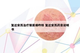 復達安蘇治療銀屑病咋樣 復達安蘇藥膏說明書