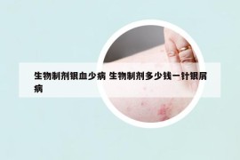 生物制劑銀血少病 生物制劑多少錢一針銀屑病