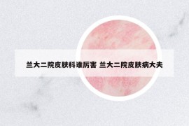 蘭大二院皮膚科誰(shuí)厲害 蘭大二院皮膚病大夫