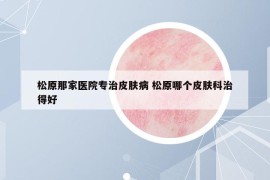 松原那家醫(yī)院專治皮膚病 松原哪個皮膚科治得好