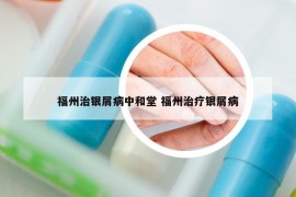 福州治銀屑病中和堂 福州治療銀屑病