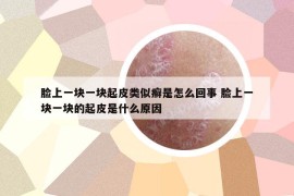 臉上一塊一塊起皮類似癬是怎么回事 臉上一塊一塊的起皮是什么原因