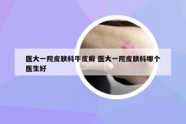 醫(yī)大一院皮膚科牛皮癬 醫(yī)大一院皮膚科哪個醫(yī)生好
