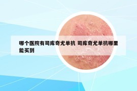哪個(gè)醫(yī)院有司庫奇尤單抗 司庫奇尤單抗哪里能買到