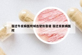 宿遷牛皮癬醫(yī)院城選楚街靠譜 宿遷皮膚病醫(yī)院