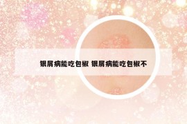 銀屑病能吃包椒 銀屑病能吃包椒不