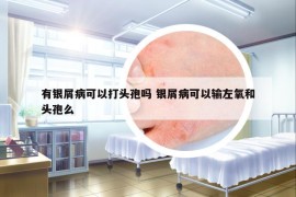 有銀屑病可以打頭孢嗎 銀屑病可以輸左氧和頭孢么