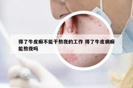 得了牛皮癬不能干熬夜的工作 得了牛皮病癬能熬夜嗎