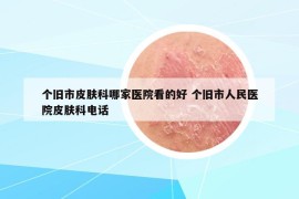個舊市皮膚科哪家醫(yī)院看的好 個舊市人民醫(yī)院皮膚科電話
