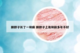 腳脖子長了一塊癬 腳脖子上有塊蘚多年不好