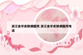 浙江金華皮膚病醫(yī)院 浙江金華皮膚病醫(yī)院電話