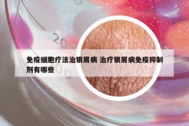 免疫細(xì)胞療法治銀屑病 治療銀屑病免疫抑制劑有哪些