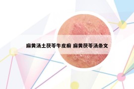 麻黃湯土茯苓牛皮癬 麻黃茯苓湯條文