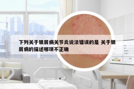 下列關(guān)于銀屑病關(guān)節(jié)炎說法錯誤的是 關(guān)于銀屑病的描述哪項不正確