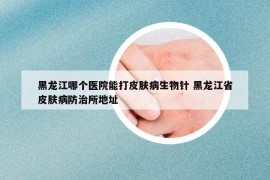 黑龍江哪個醫(yī)院能打皮膚病生物針 黑龍江省皮膚病防治所地址