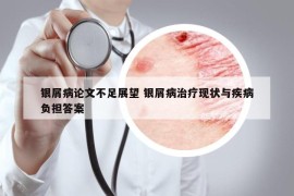 銀屑病論文不足展望 銀屑病治療現(xiàn)狀與疾病負(fù)擔(dān)答案